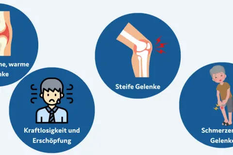 Illustrationen zeigen geschwollene, warme und steife Gelenke, Kraftlosigkeit und schmerzende Gelenke, typische Symptome von chronischer Polyarthritis.