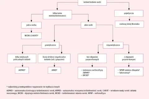 Schemat diagnostyczny torbieli/torbieli nerek. Rozróżnia się torbiele pojedyncze i mnogie, z objawami lub bez.