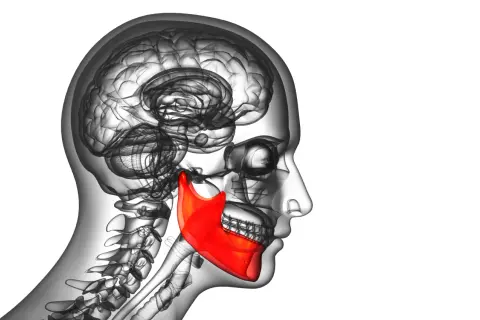 Illustrazione anatomica del cervello e della mandibola in evidenza rossa, che potrebbe rappresentare il movimento involontario di battere i denti.
