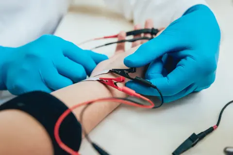 Lekarz w niebieskich rękawiczkach podłącza elektrody do ręki pacjenta. To badanie EMG, które pozwala ocenić funkcję nerwów i mięśni.