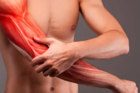 Widok mięśni ramienia, w tym bicepsu, z zaznaczonymi włóknami.