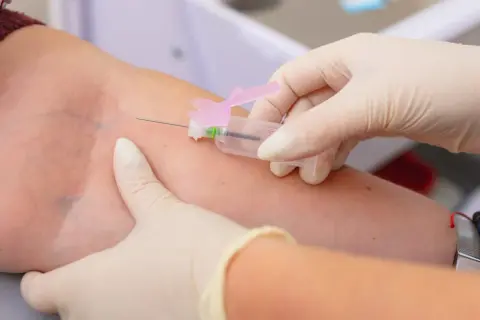 Wysokie limfocyty w morfologii: kiedy to sygnał infekcji, a kiedy alarm?