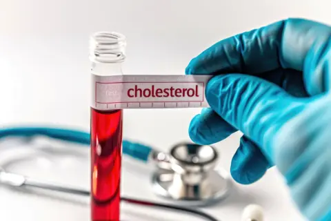 Jaki lekarz leczy cholesterol i jak uniknąć poważnych problemów zdrowotnych