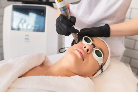 Kobieta w okularach ochronnych poddaje się zabiegowi laserowego liftingu twarzy.