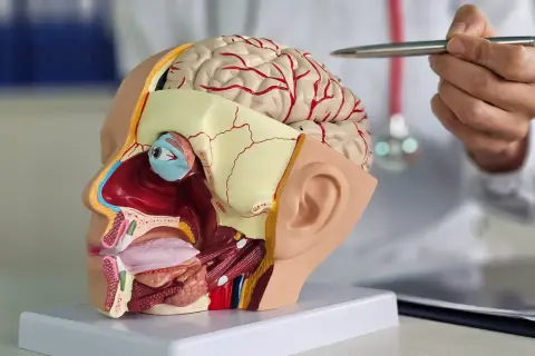 Medizinisches Modell eines Kopfes mit Gehirn, Auge und Mund. Ein Arzt erklärt, was nach dem Essen Kopfdruck verursachen könnte.
