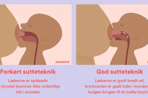 Illustrationer visar fel och rätt amningsteknik. Fel teknik: spetsade läppar, kort tungband kan hindra. Rätt teknik: breda läppar, bröstvårtan djupt inne, tungan mjölkar bröstet.