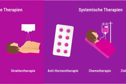 Illustration zeigt lokale und systemische Therapien bei Brustkrebs: Operation, Strahlentherapie, Hormontherapie, Chemotherapie, zielgerichtete Therapie.