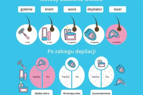 Depilacja laserowa co ile tygodni? Odkryj sekret skuteczności!