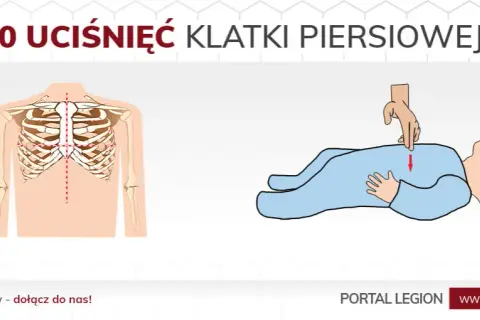 Ile ucisków klatki piersiowej? Kluczowe zasady RKO dla każdego