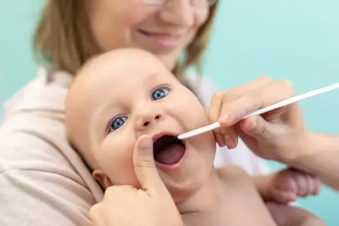 Niemowlę z szeroko otwartymi ustami, któremu lekarz bada wędzidełko.