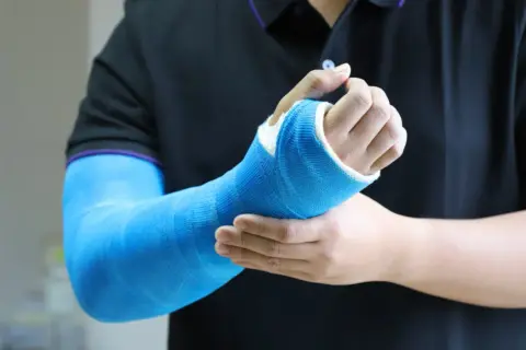 Jak pozbyć się swędzenia pod gipsem - skuteczne metody ulgi