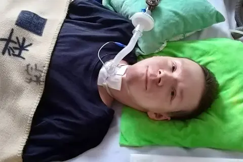 Chłopiec z dystrofią mięśniową Duchenne'a leży w łóżku, podłączony do respiratora.