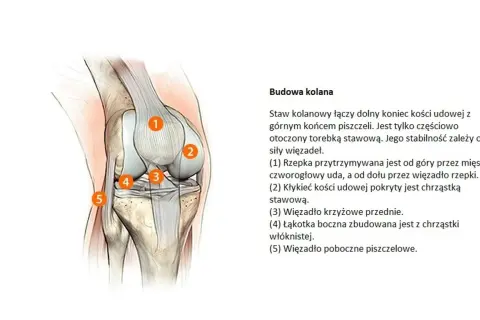 Anatomia kolana z zaznaczonymi elementami, ważna przy diagnostyce gonartrozy.