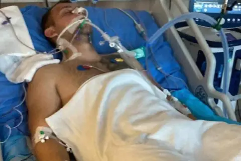 Śpiączka po udarze: ile trwa? Realne ramy czasowe i rokowania
