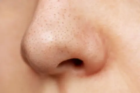 Skóra nosa z widocznymi porami. Ten **acne krem na niedoskonałości z lha i jonami srebra** może pomóc w walce z problemami skórnymi.