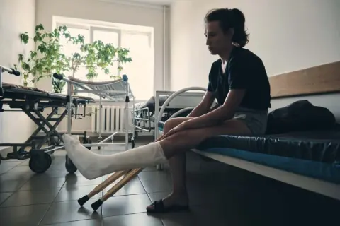 Kobieta z nogą w gipsie i kulami czeka na rehabilitację po złamaniu nogi.