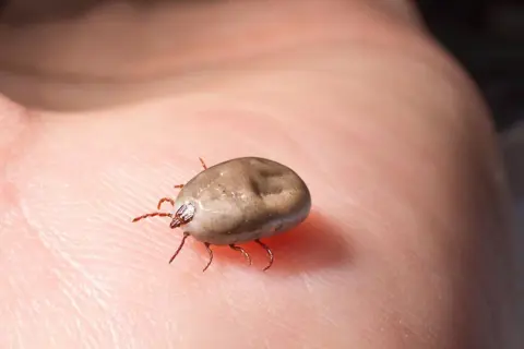 Kleszcz na dłoni, potencjalne źródło boreliozy i FSME. Immunizacja jest kluczowa.