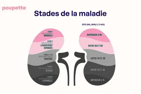 Schéma des stades de la maladie rénale, de la fonction normale à l'insuffisance terminale. Un taux de créatinine haut peut indiquer ces stades avancés.