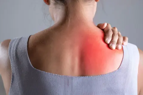Donna con mano sulla spalla, evidenziata un'area rossa che indica dolore in mezzo alle scapole.