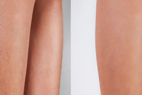 Ile trwa depilacja laserowa bikini? Od wizyty po trwały efekt