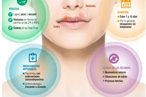 El herpes labial, con sus causas como el estrés y el sol, evoluciona de picor a vesículas y costras.