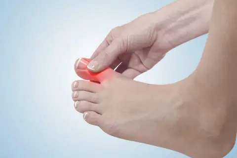 Schmerzender Zeh, möglicherweise durch Überlastung des extensor hallucis longus.