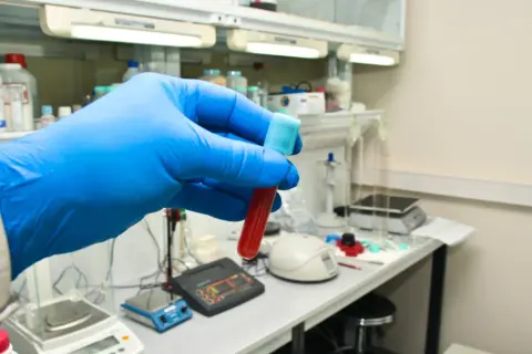 Ręka w niebieskiej rękawiczce trzyma probówkę z krwią. W tle laboratorium, gdzie badane są bazofile podwyższone u dziecka.