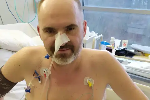 Mężczyzna w szpitalu z sondą nosową i elektrodami na klatce piersiowej. Jego walka z rakiem trzustki i rokowania są trudne, ale nie traci nadziei.
