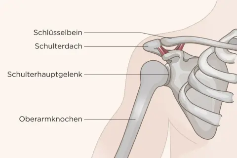 Anatomie der Schulter: Schlüsselbein, Schulterdach, Schulterhauptgelenk und Oberarmknochen. Mögliche Ursachen für Schulter Arm Syndrom.