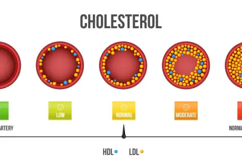 Jaki cholesterol jest dobry i jak poprawić jego poziom w organizmie
