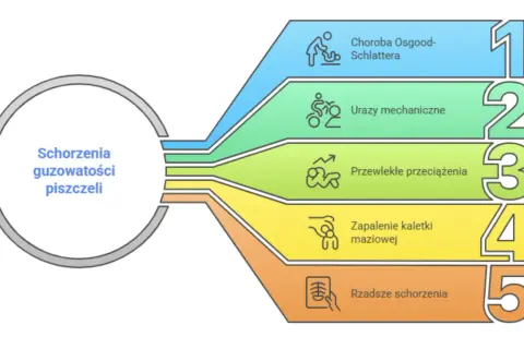 Schemat przedstawia schorzenia guzkowatości piszczeli, w tym chorobę Osgooda-Schlattera, urazy mechaniczne, przewlekłe przeciążenia, zapalenie kaletki maziowej i rzadsze schorzenia.