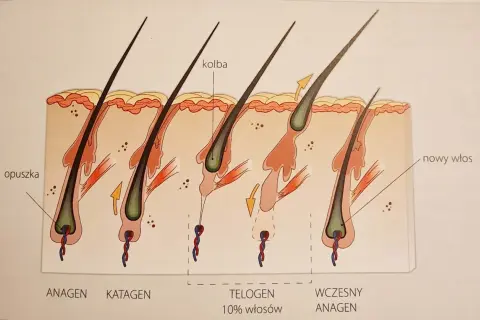 Cykl wzrostu włosa: anagen, katagen, telogen (10% włosów wypada dziennie), wczesny anagen.