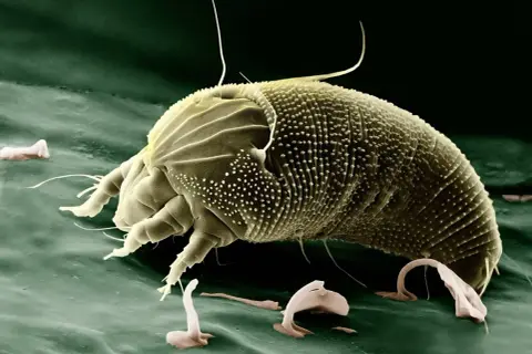 Microscopic view of a dust mite, a common allergen. These tiny creatures can dust mites live in memory foam, feeding on skin flakes.