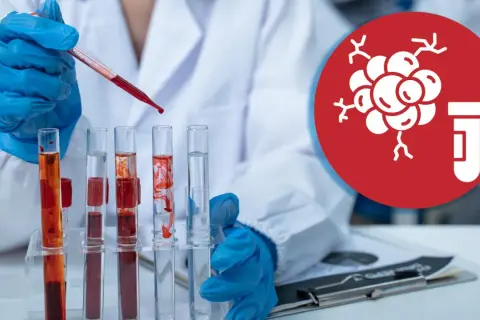 Laborant mit blauen Handschuhen tropft Blut in Reagenzgläser. Symbol für Tumormarker im Blut.
