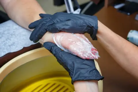 Dłonie w czarnych rękawiczkach owijają dłoń w folię, obok żółta wanna z płynem.