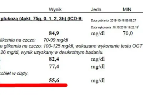 Krzywa cukrowa: Jak się przygotować i uzyskać wiarygodny wynik?