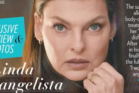 Kriolipoliza czy liposukcja kawitacyjna? Ekspert radzi!