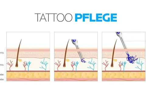 Illustration zeigt, wie Pigmente in die Dermis eingebracht werden. Wichtig für die tattoo pflegen nach dem stechen.