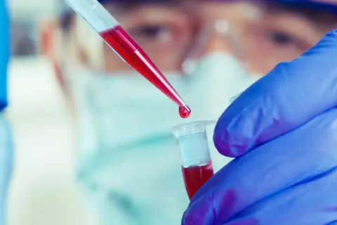 Jak długo jest ważne skierowanie do laboratorium? Uniknij problemów z ważnością