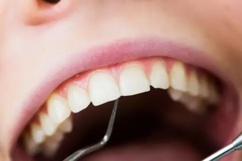 Usta z widocznym małym ubytkiem w zębie, badane narzędziem dentystycznym.