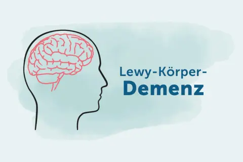 Profil eines Kopfes mit Gehirn. Text: Lewy-Körper-Demenz. Erfahrungsberichte gesucht.