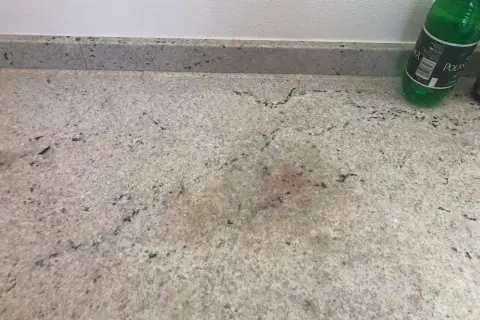 Plamy na jasnym granicie blatu. Szukam domowych sposobów na tłuste plamy.