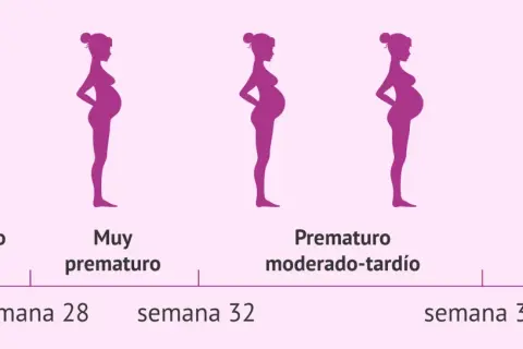 Siluetas de embarazos y un bebé. Muestran que a partir de la semana 28 puede nacer un bebé prematuro.