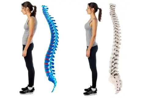 Postura scorretta e dolori addominali: confronto tra colonna vertebrale curva e dritta.