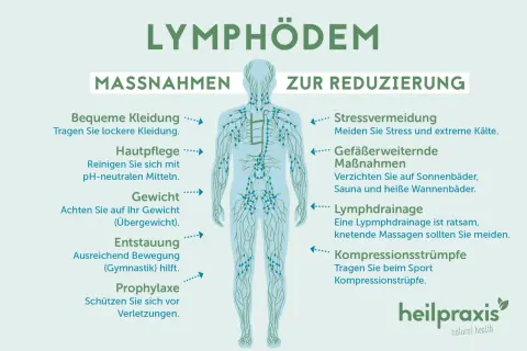 Lymphödem-Maßnahmen: Bequeme Kleidung, Hautpflege, Gewichtskontrolle, Bewegung, Stressvermeidung, Lymphdrainage. Symptome im Gesicht können durch diese Maßnahmen gelindert werden.