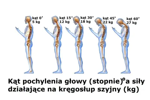 Schylanie się nad telefonem obciąża kręgosłup szyjny. Im większy kąt pochylenia głowy, tym większa siła działa na szyję.