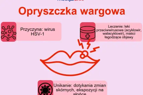 Jak zapobiec opryszczce? Odkryj sekrety trwałej odporności
