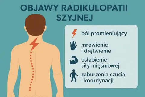 Ilustracja przedstawia sylwetkę człowieka z zaznaczonym kręgosłupem szyjnym i objawami radikulopatii: ból, mrowienie, osłabienie mięśni.