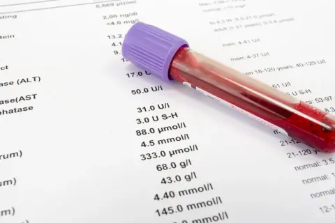 Wyniki badań krwi z probówką. Na papierze widnieje lista testów, w tym enzymy jak ALT i AST, oraz wartości referencyjne.