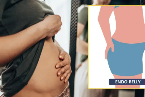 Endometrioza a menopauza: Czy to koniec bólu? Prawda i mity.